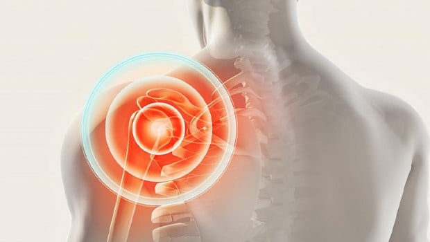 کشیدگی تاندون شانه